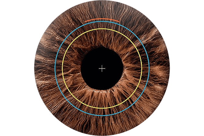 A close-up, top-down view of a brown human iris enhanced by SmartSight Nova, featuring a black pupil, a small white cross at the centre, and three coloured concentric circles—red, yellow, and blue—overlaid on the image.